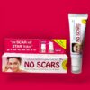 NO SCARS CREAM 20 GM - Image 2